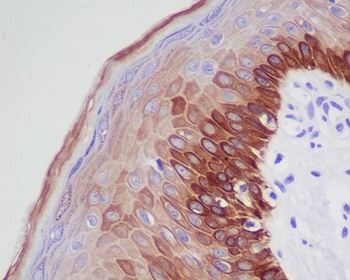 Cytokeratin 16 KRT16 Rabbit Monoclonal Antibody