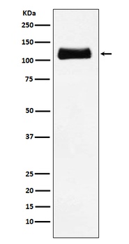 ApoER2 Rabbit Monoclonal Antibody