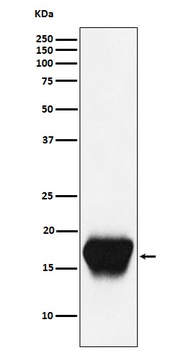 CD52 Rabbit Monoclonal Antibody