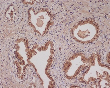 Bad Rabbit Monoclonal Antibody