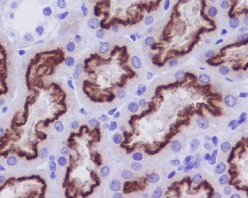 Anti-Cubilin CUBN Rabbit Monoclonal Antibody