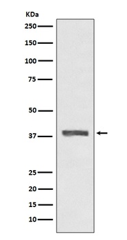 AMPK beta 1 PRKAB1 Rabbit Monoclonal Antibody