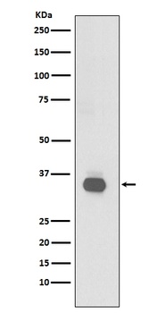 CD20 MS4A1 Rabbit Monoclonal Antibody