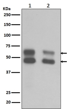 Anti-CaMKII CAMK2B Rabbit Monoclonal Antibody