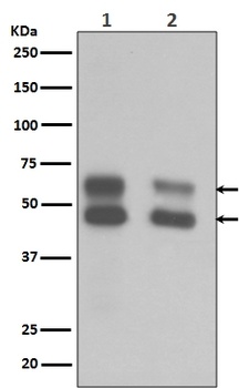 CaMKII CAMK2B Rabbit Monoclonal Antibody