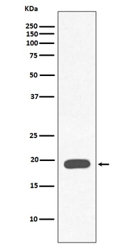 Myoglobin MB Rabbit Monoclonal Antibody