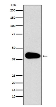 PAR6 Rabbit Monoclonal Antibody
