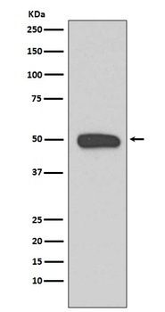 Cytokeratin 13 Rabbit Monoclonal Antibody