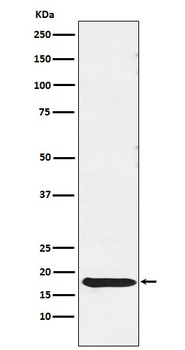 TSH beta Rabbit Monoclonal Antibody