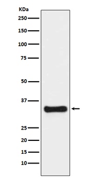 Thymidylate Synthase TYMS Rabbit Monoclonal Antibody