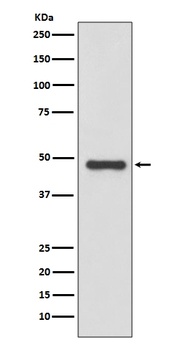 Urokinase Rabbit Monoclonal Antibody