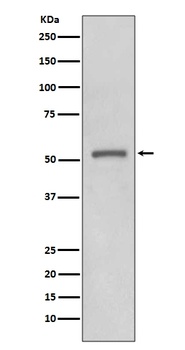 MMP11 Rabbit Monoclonal Antibody