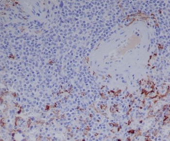 Anti-Human IgG IGHG1 Rabbit Monoclonal Antibody