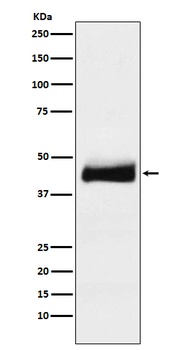 ORM1 Rabbit Monoclonal Antibody