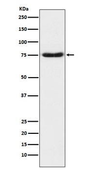 Netrin 1 NTN1 Rabbit Monoclonal Antibody