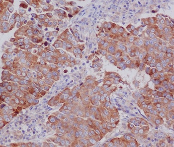 PUMA BBC3 Rabbit Monoclonal Antibody