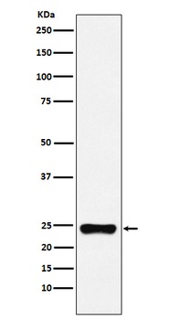 BAG2 Monoclonal Antibody