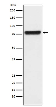 KLKB1 Rabbit Monoclonal Antibody