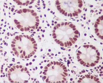 Anti-PTBP2 Rabbit Monoclonal Antibody