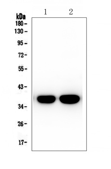 Synaptophysin SYP Rabbit Monoclonal Antibody