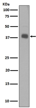 Synaptophysin SYP Rabbit Monoclonal Antibody