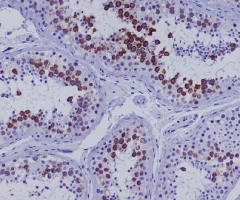 Anti-CD168 HMMR Rabbit Monoclonal Antibody