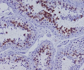 CD168 HMMR Rabbit Monoclonal Antibody