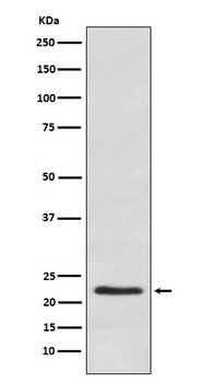 Placental lactogen CSH1 Rabbit Monoclonal Antibody