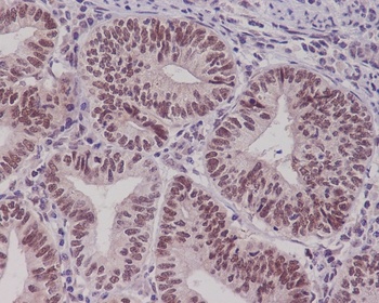 Pygopus 2 Rabbit Monoclonal Antibody