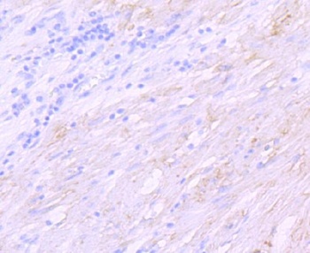 delta Sarcoglycan SGCD Rabbit Monoclonal Antibody