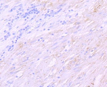 Anti-delta Sarcoglycan SGCD Rabbit Monoclonal Antibody