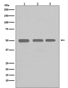 Anti-beta I Tubulin TUBB1 Rabbit Monoclonal Antibody