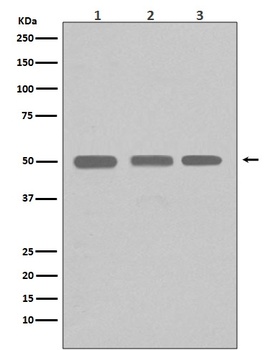 beta I Tubulin TUBB1 Rabbit Monoclonal Antibody