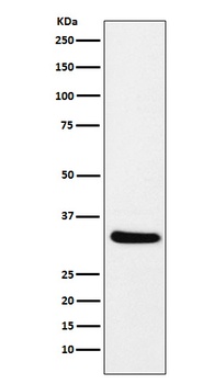 CRALBP RLBP1 Rabbit Monoclonal Antibody