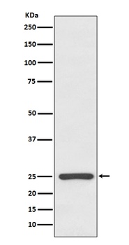 Kappa light chain IGKC Rabbit Monoclonal Antibody