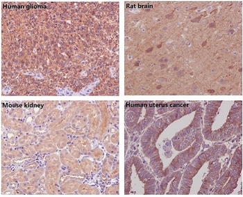 Anti-beta Tubulin TUBB Rabbit Monoclonal Antibody