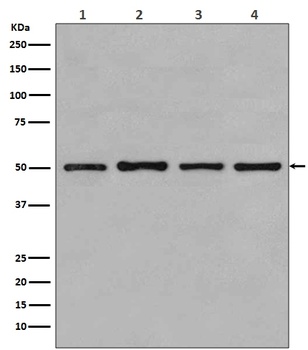 Anti-beta Tubulin TUBB Rabbit Monoclonal Antibody