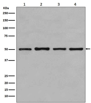 beta Tubulin TUBB Rabbit Monoclonal Antibody