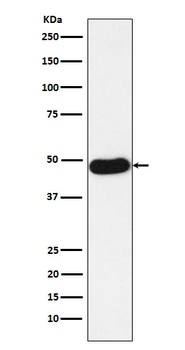 Napsin A NAPSA Rabbit Monoclonal Antibody