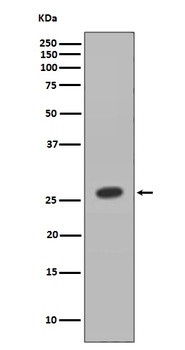 HOXB9 Rabbit Monoclonal Antibody