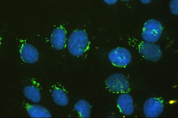 Anti-GM130 GOLGA2 Antibody (monoclonal, 6D4)