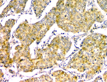 Anti-GM130 GOLGA2 Antibody (monoclonal, 6D4)