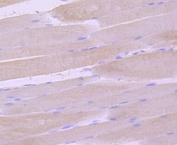 gamma Sarcoglycan Rabbit Monoclonal Antibody