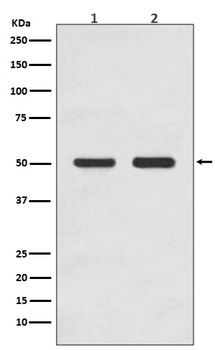 AP2M1/Ap 2 Mu 1 Rabbit Monoclonal Antibody (Ap)