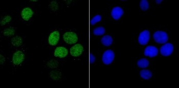 Anti-Histone H1.2 Monoclonal Antibody