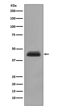 Cytokeratin 15 Rabbit Monoclonal Antibody