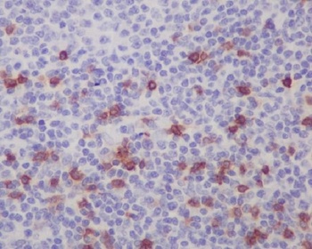 Integrin alpha E ITGAE Rabbit Monoclonal Antibody