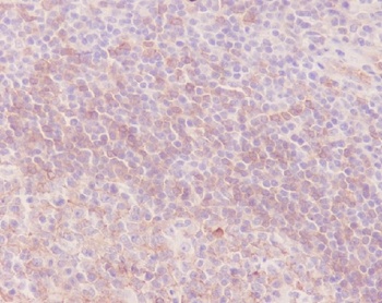 IGHM Rabbit Monoclonal Antibody