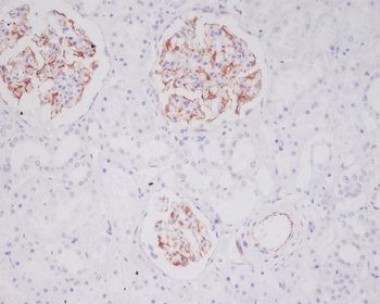 Mast Cell Tryptase Rabbit Monoclonal Antibody