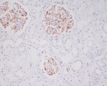 Anti-Mast Cell Tryptase Rabbit Monoclonal Antibody